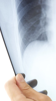 X-Ray