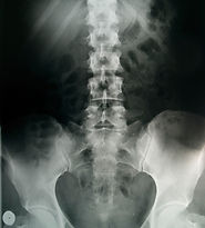 Pelvic X-Ray